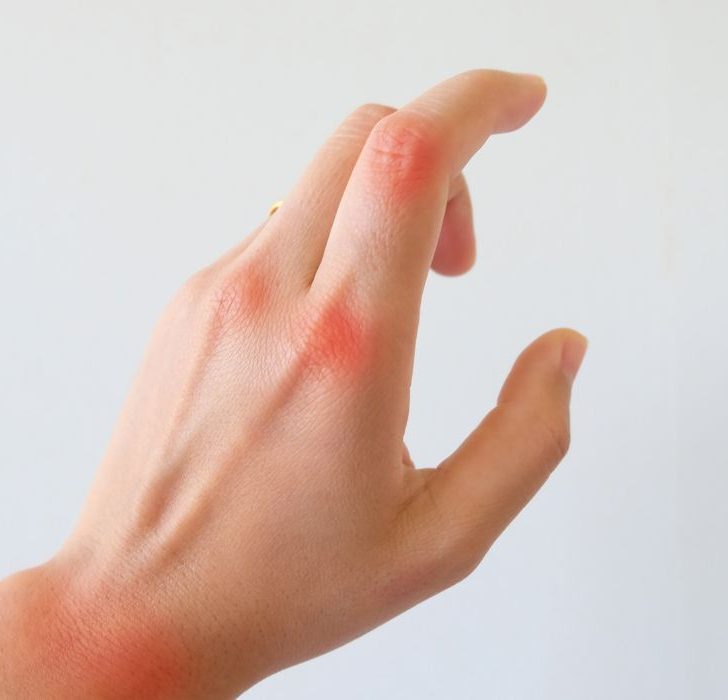 Bike Handlebars for Arthritis Reduce Symptoms when Cycling Cycle